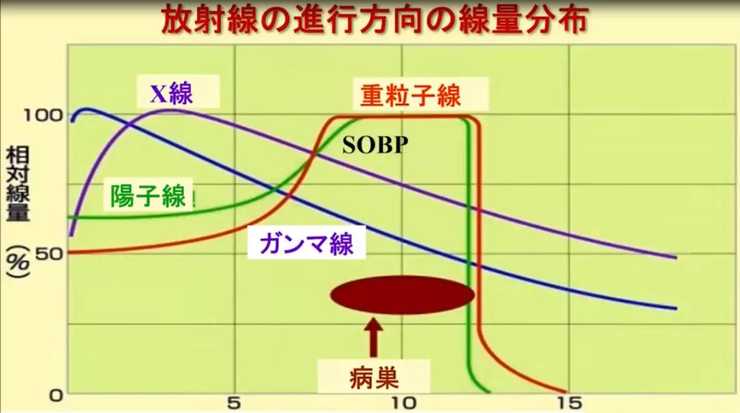 日本质子重离子治疗